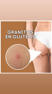 Cuidado de la piel de los glúteos